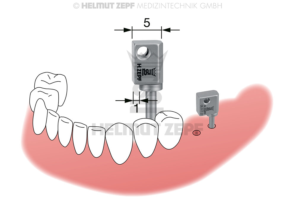 FLAGGENHALTER ZUR EINFACHEN ÜBERPRÜFUNG DER PARALLELITÄT VON IMPLANTATBOHRUNGEN BREITE 5MM FÜR FRONTZÄHNE UND PRÄMOLAREN