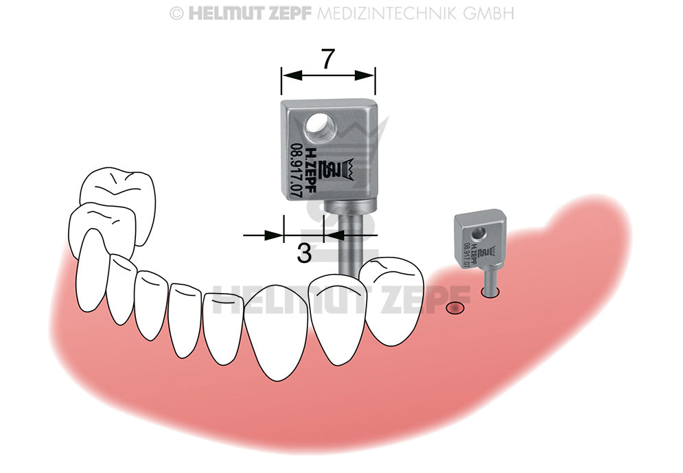 FLAGGENHALTER ZUR EINFACHEN ÜBERPRÜFUNG DER PARALLELITÄT VON IMPLANTATBOHRUNGEN BREITE 7MM FÜR MOLAREN