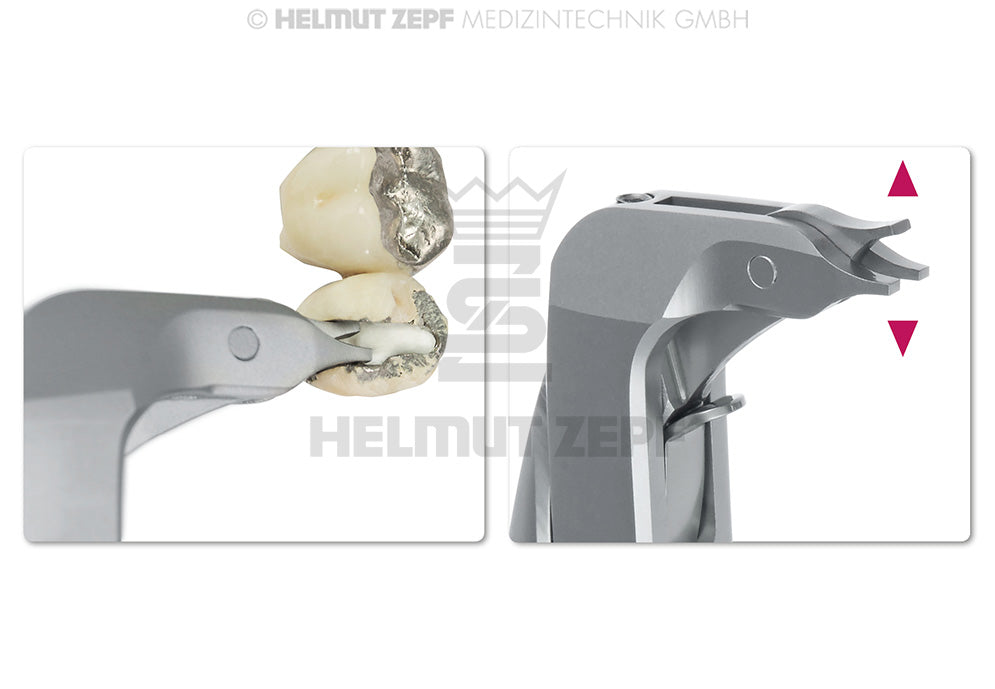 ZEPF - KRONEN-SPREIZ-ZANGE, 14,5 CM, GRIFF IN XCISION-LINIE, NACH BAUER, MODIF. NEUES MODELL